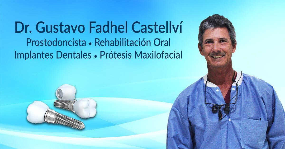 implantes dentales y prostodoncista: Dr Gustavo Fadhel
